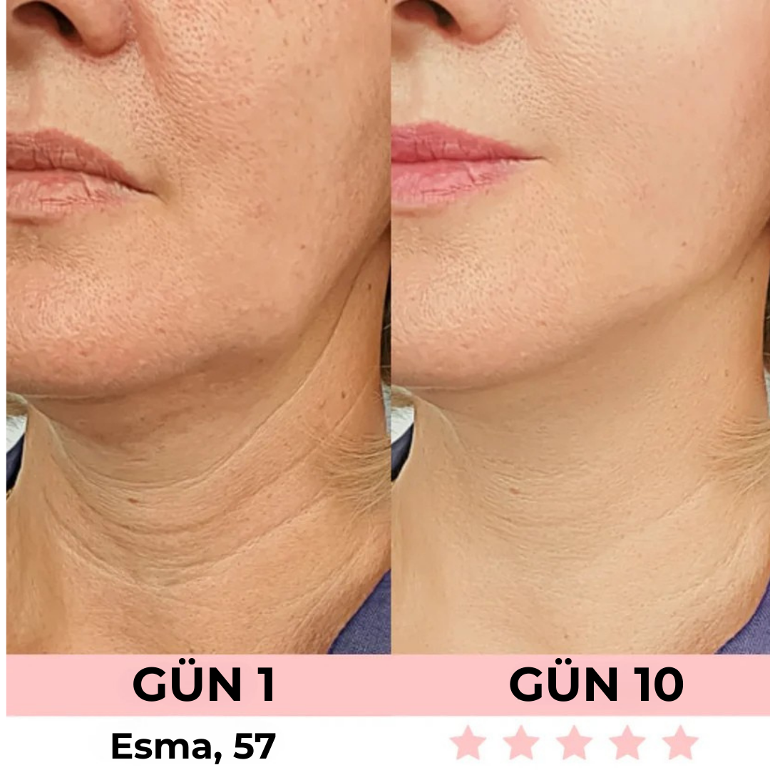 Skinova™ - Güzelliğin Sırrı